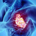 cardiovascular