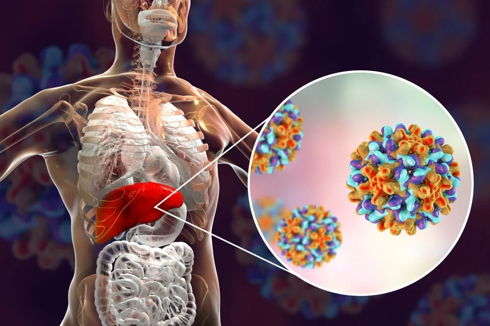 hepatitis