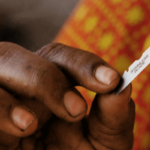 FGM
