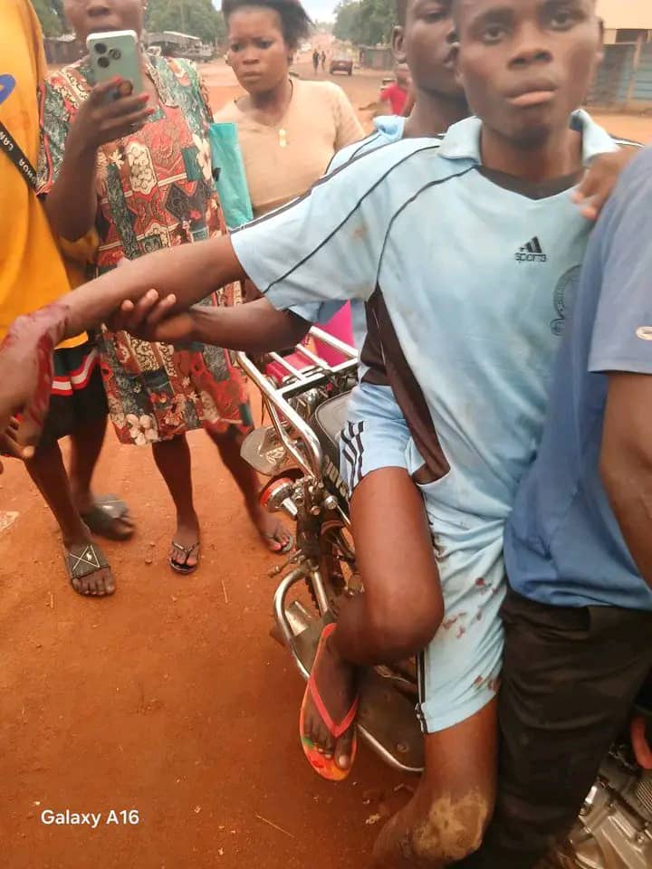 Injured students and a resident and the burnt property at the palace of Mue-Ter Ichongo, Chief Simon Baver