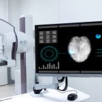 Mammogram machine