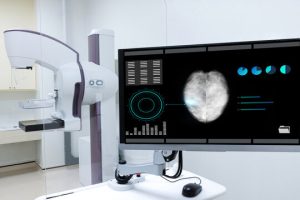 Mammogram machine