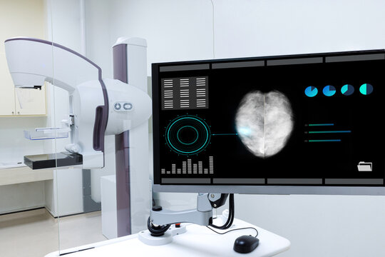 Mammogram machine