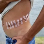 Poverty, inequality drive Nigeria’s kidney trafficking racket