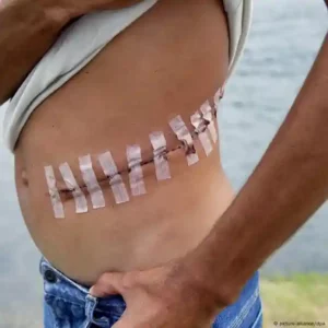 Poverty, inequality drive Nigeria’s kidney trafficking racket
