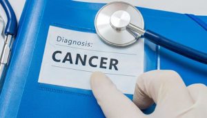 DIAGNOSIS-CANCER