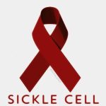 Sickle Cell
