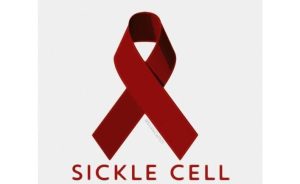 Sickle Cell