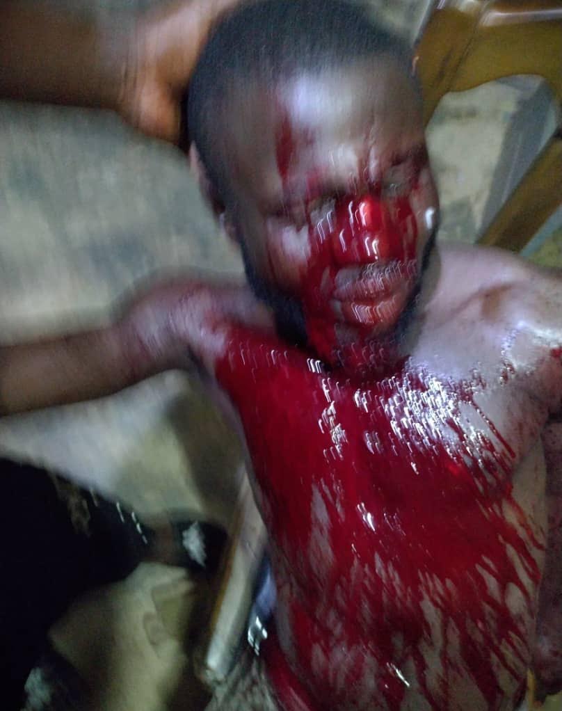 Osun: Three injured in APC, PDP clash after Supreme Court ruling