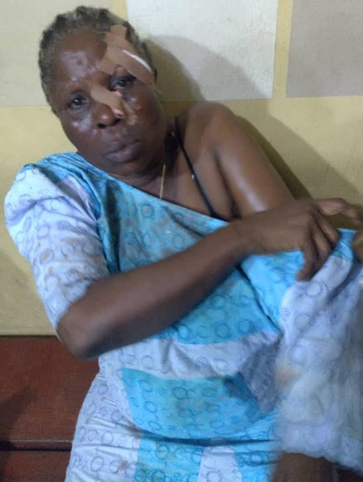 Osun: Three injured in APC, PDP clash after Supreme Court ruling