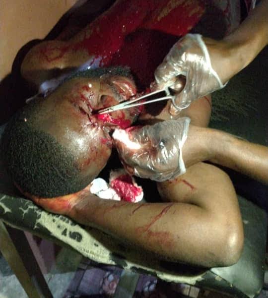 Osun: Three injured in APC, PDP clash after Supreme Court ruling