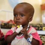 Child malnutrition