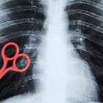 Scissors patient body xray