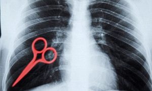 Scissors patient body xray