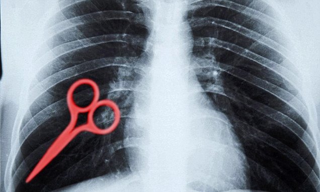 Scissors patient body xray