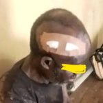 A survivor of Tuesday attack