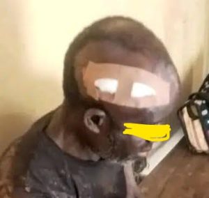 A survivor of Tuesday attack