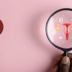 Cervical cancer screening
