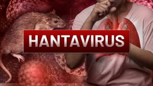 HANTAVIRUS