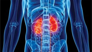 KIDNEYS