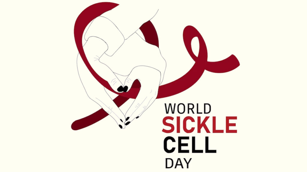 Early-Diagnosis-And-Sickle-Cell-Disease-Main