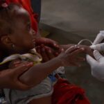 cholera epidermic
