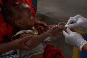 cholera epidermic