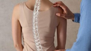 Scoliosis-1200×834-1-700×394