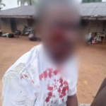 Ebonyi: Police arrest officers for gouging man’s eye