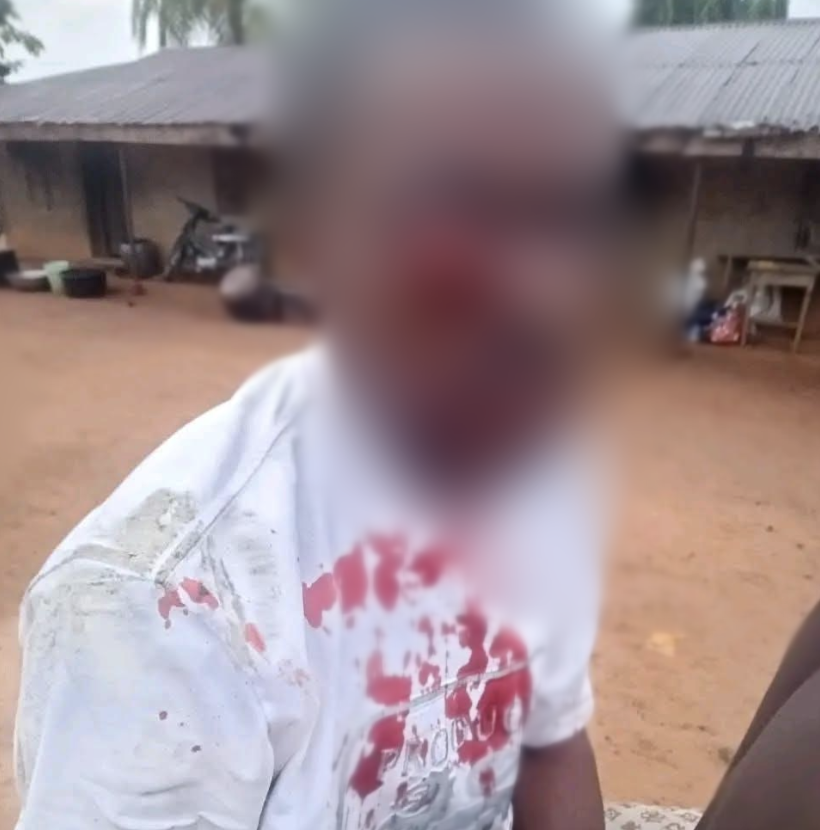 Ebonyi: Police arrest officers for gouging man’s eye