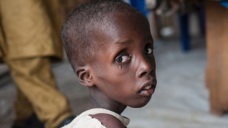Governance failures driving child malnutrition crisis in Northern Nigeria, report warns