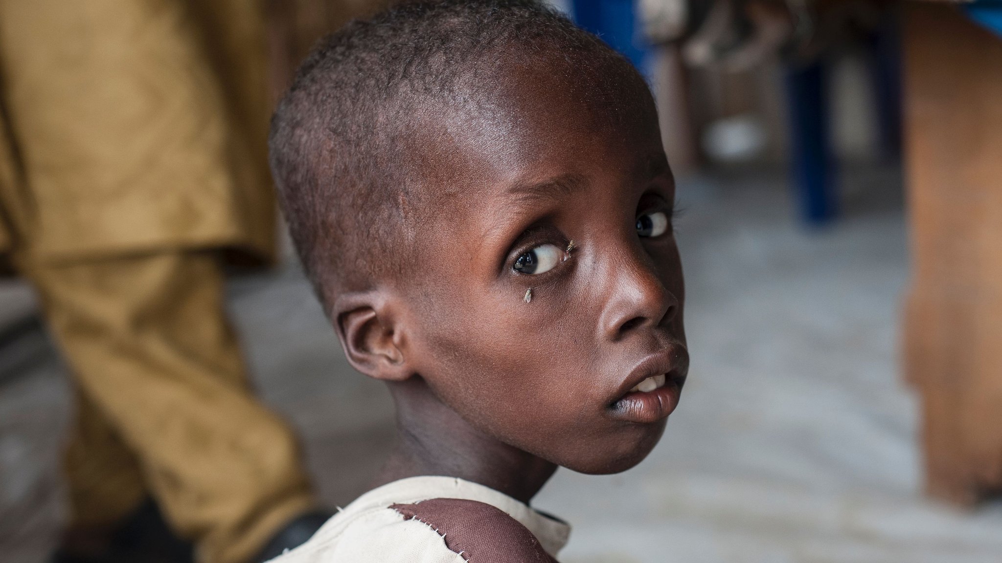 Governance failures driving child malnutrition crisis in Northern Nigeria, report warns