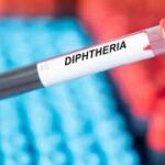 Diphtheria-