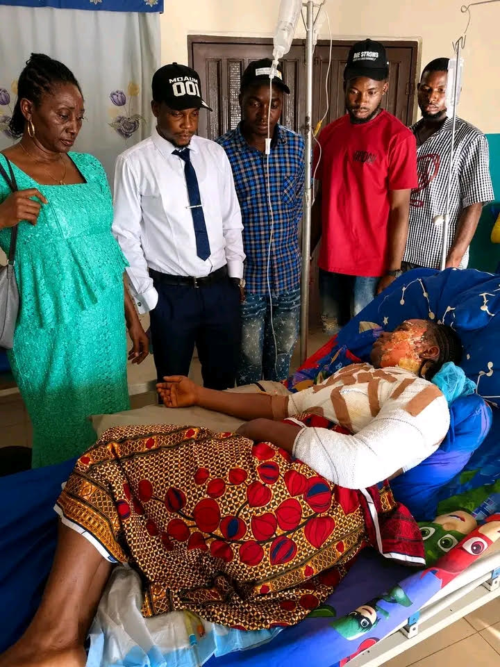 Benue: Student hospitalised after being scalded in hot water attack